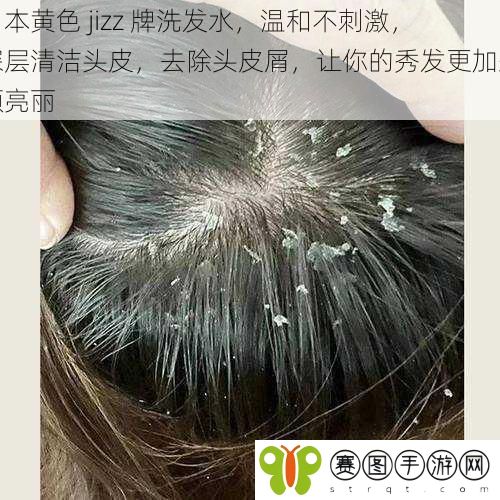 日本黄色 jizz 牌洗发水,温和不刺激,深层清洁头皮,去除头皮屑,让你的秀发更加柔顺亮丽