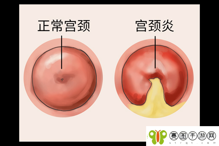 啪啪顶到最里面流血情况是否常见及相关探讨