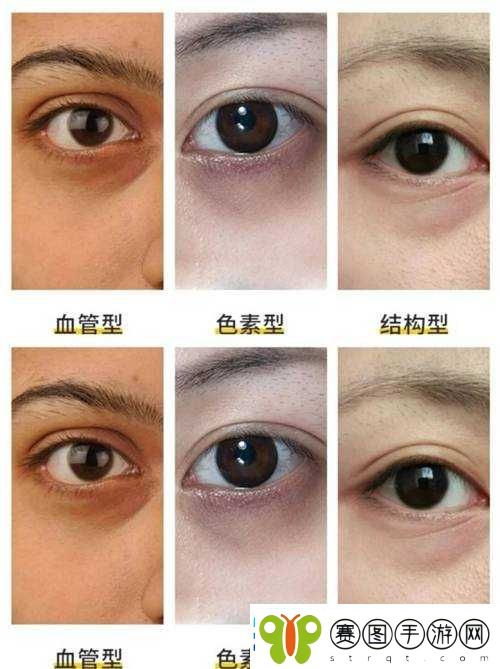 眼部