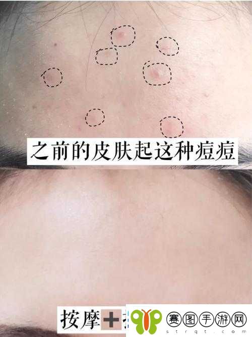 老中医用嘴排阴毒