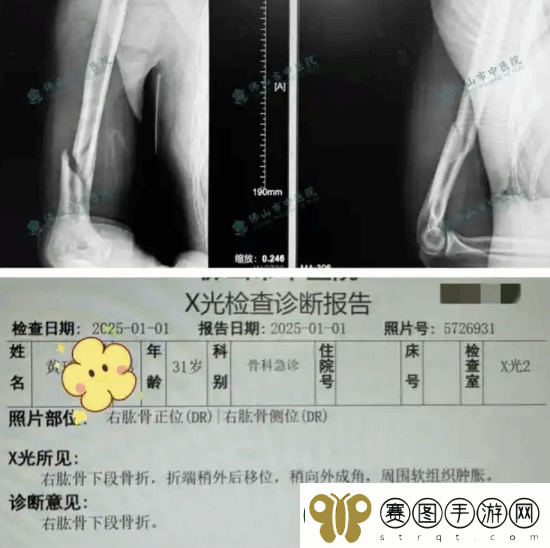 俩小伙挑战与机器人“掰手腕”