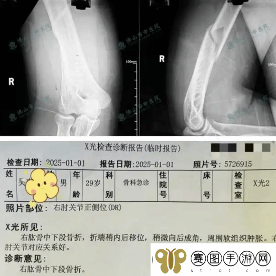 俩小伙挑战与机器人“掰手腕”