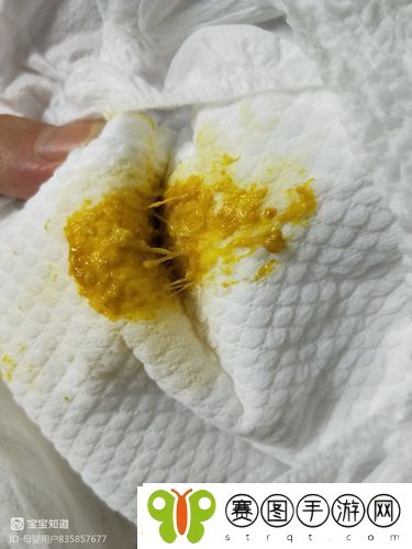 水拉丝了小东西喷出来了怎么办