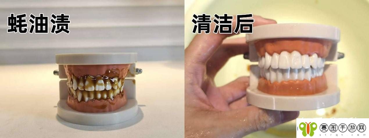 2025年口腔护理新宠！知乎大咖力荐欧可林AirPump