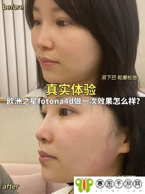 欧洲之星4D做一次效果怎么样
